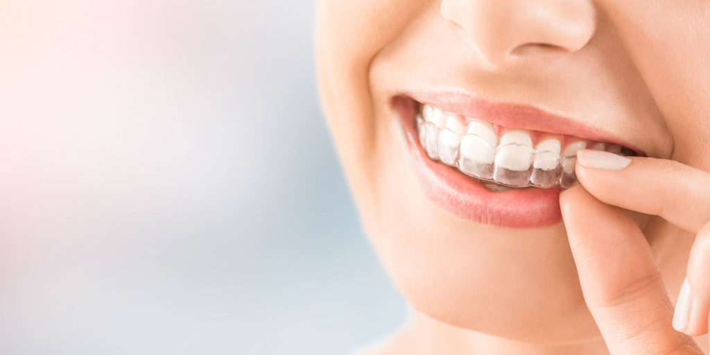 dental patient wearing invisalign