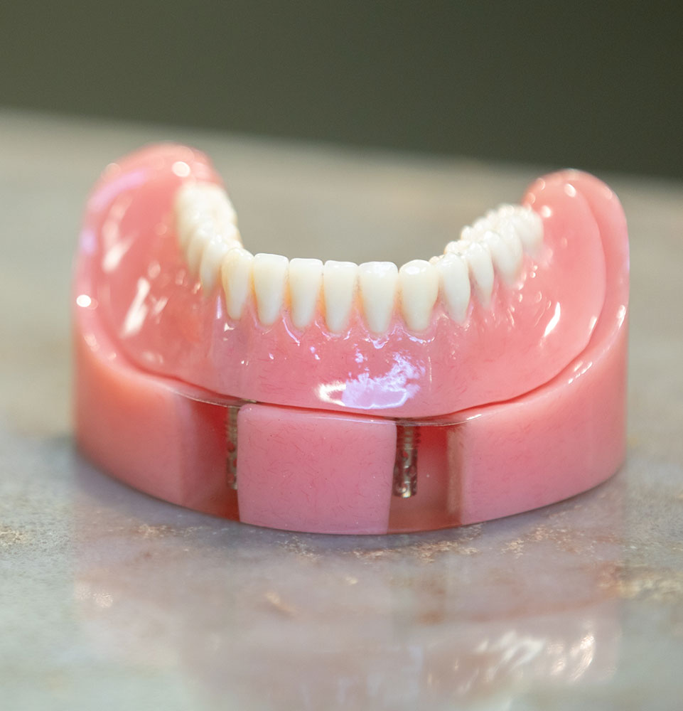 denture prothesis