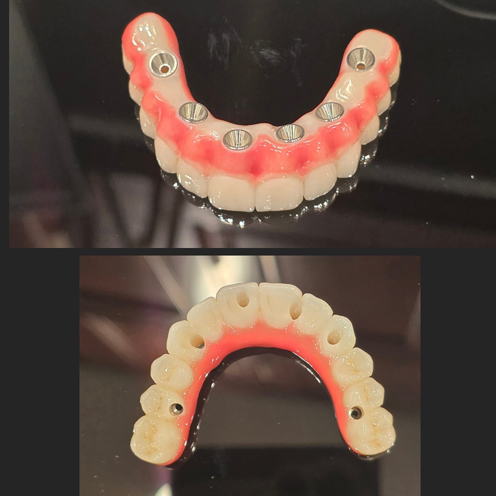 before after just arch